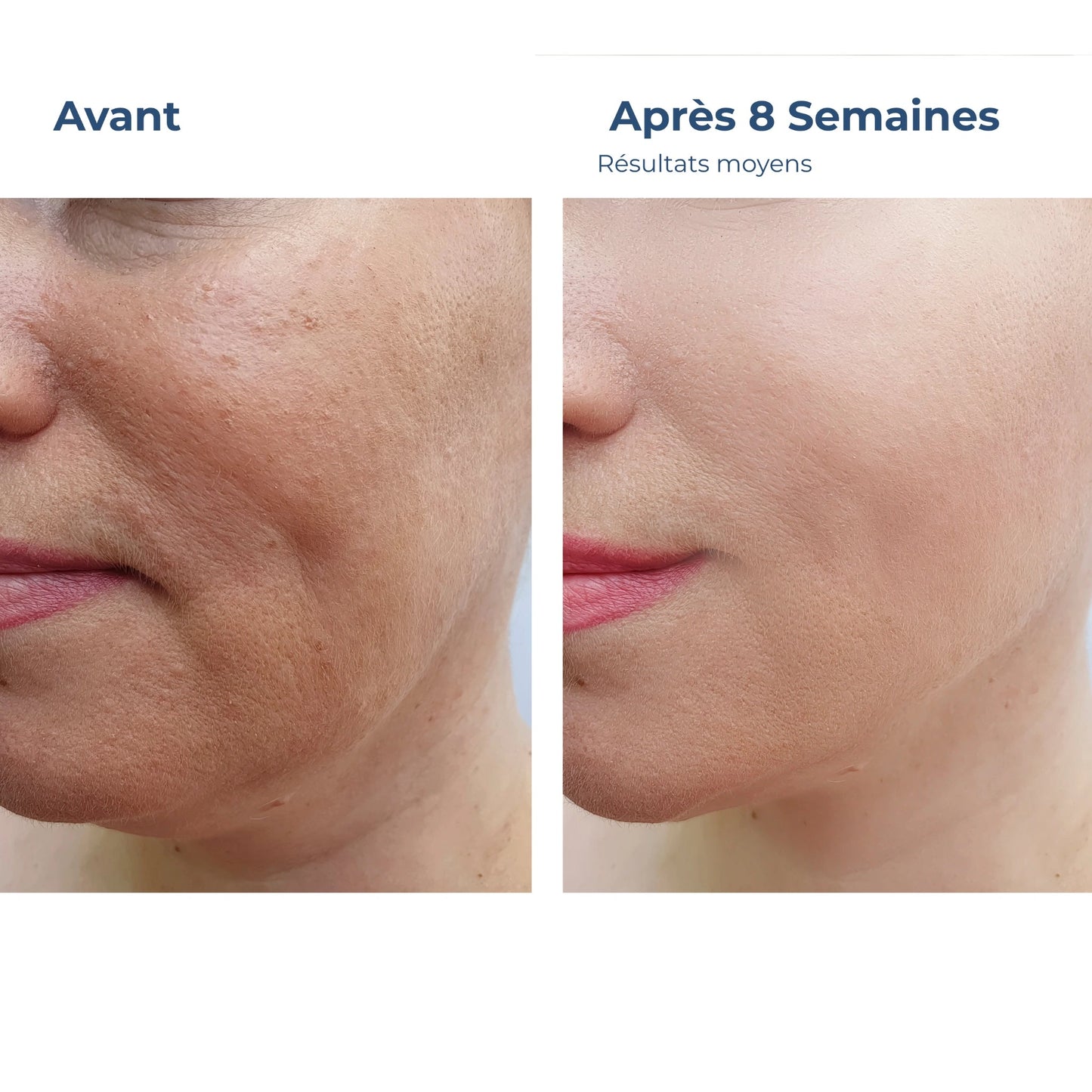 Sérum Éclat Vitamine C - Illumine & Protège - Glowyritual.com