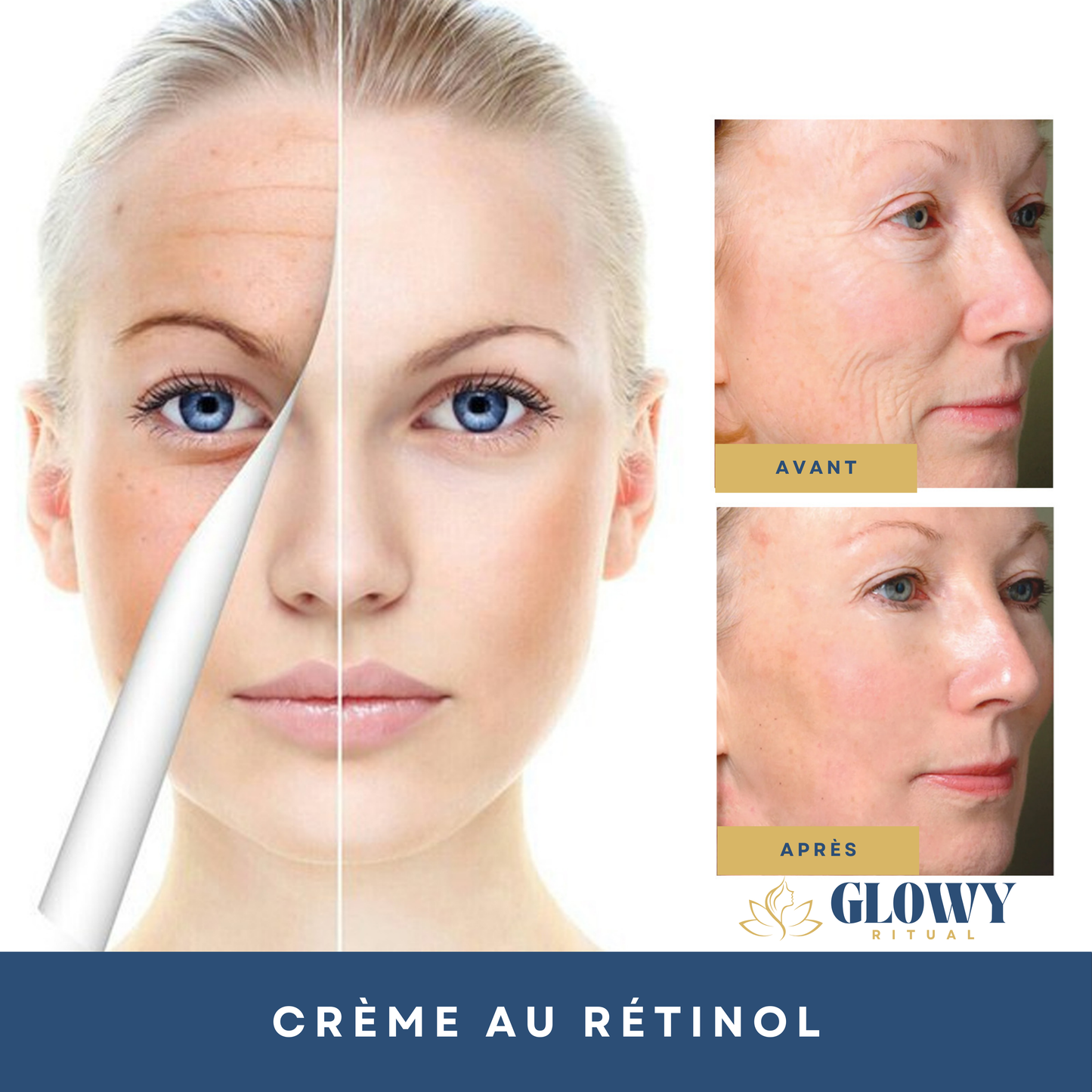 Crème au Rétinol Anti-Âge