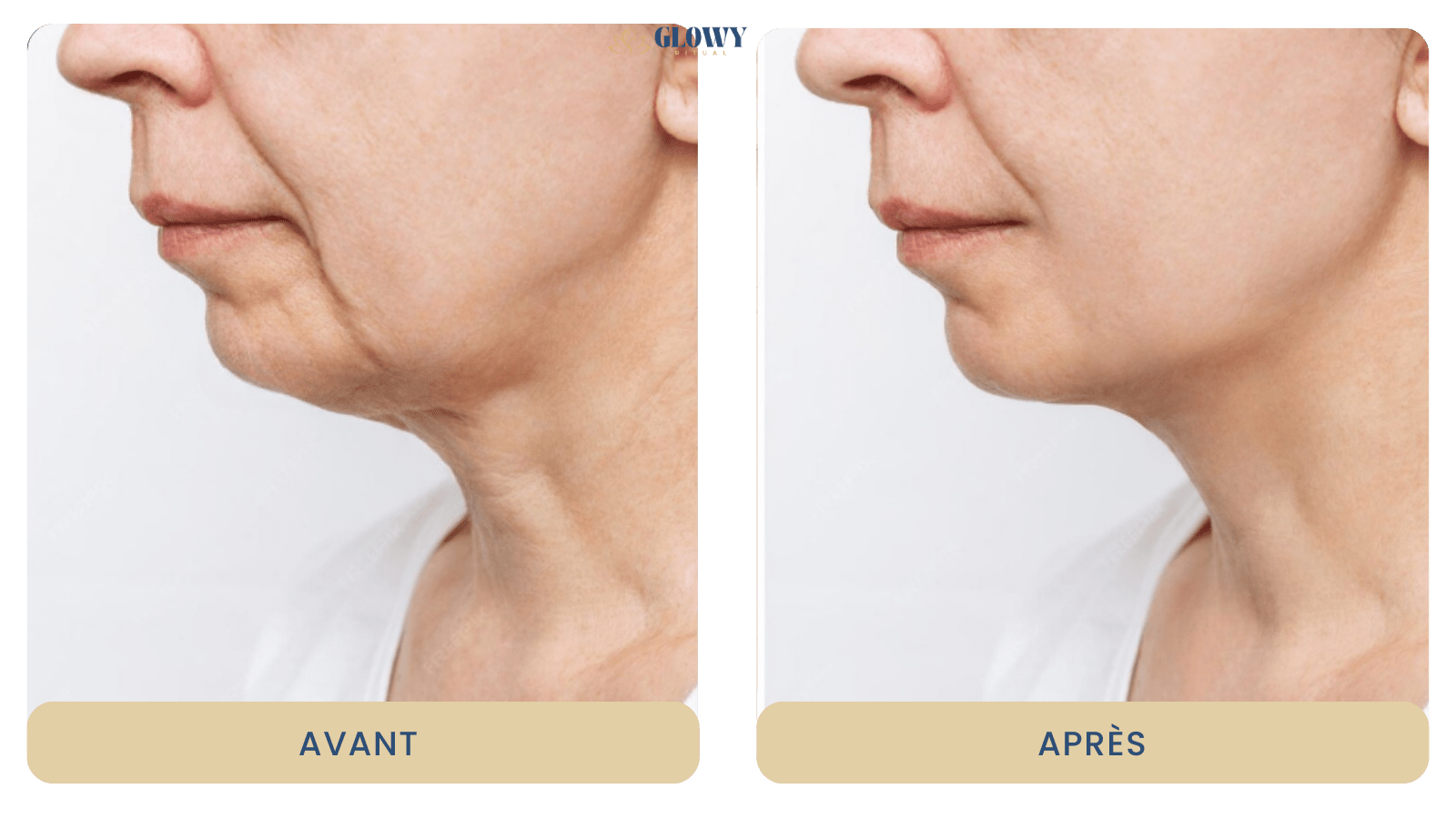 Gua Sha Électrique - Glowyritual.com
