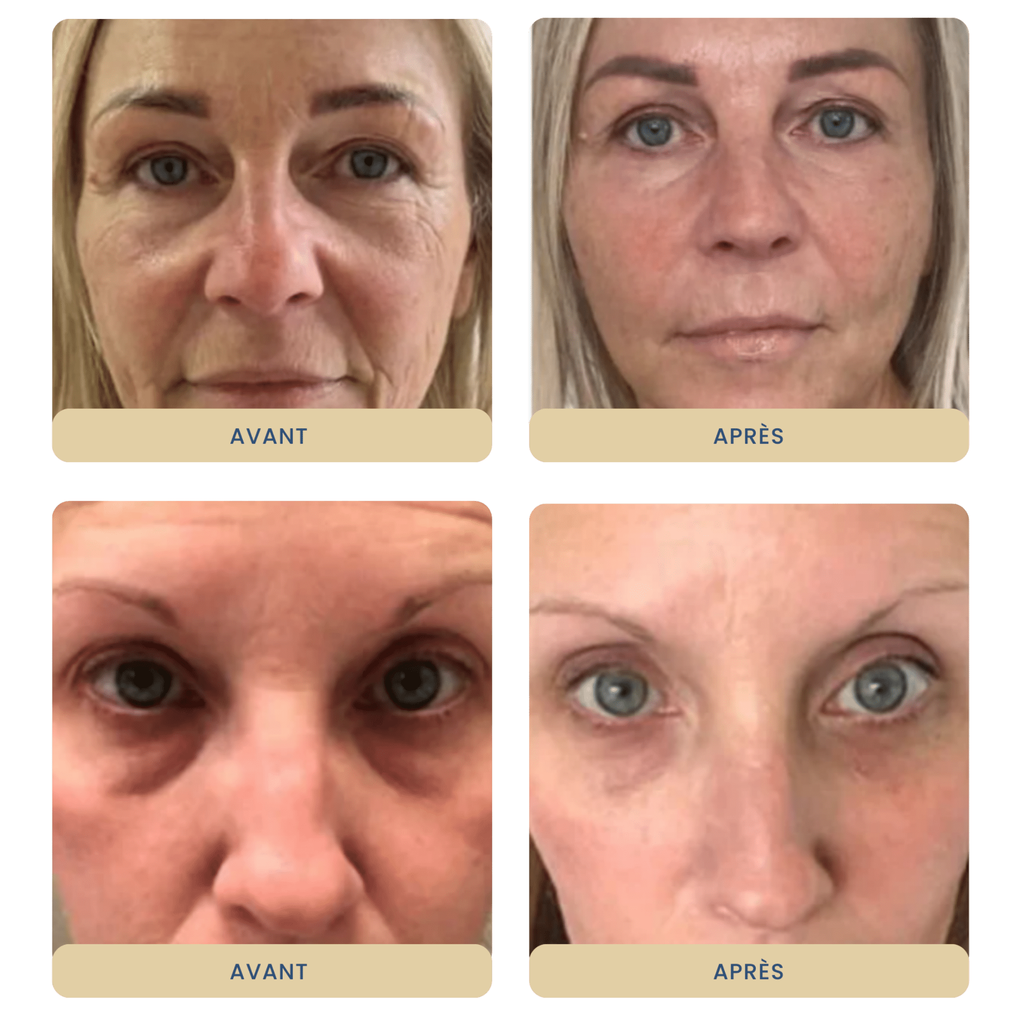 Masque Facial Biocollagène - Glowyritual.com