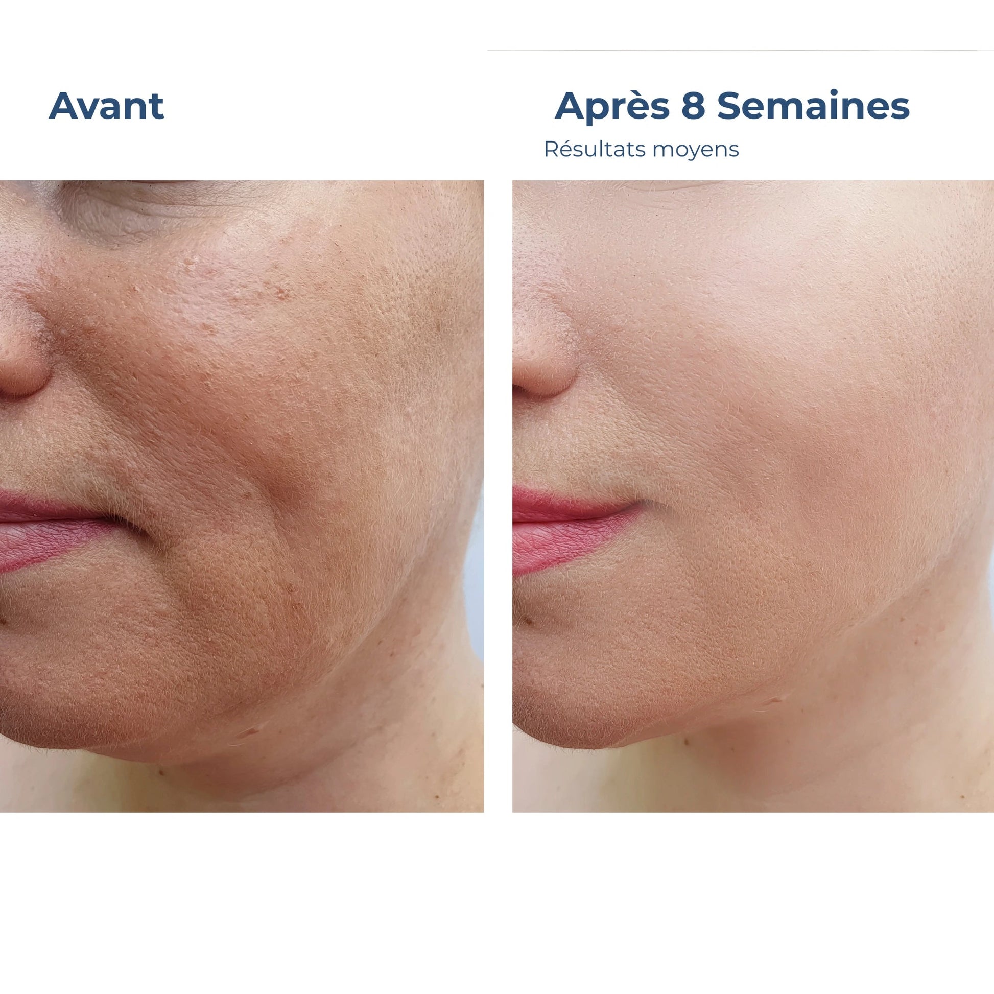 Sérum Éclat Vitamine C - Illumine & Protège - Glowyritual.com