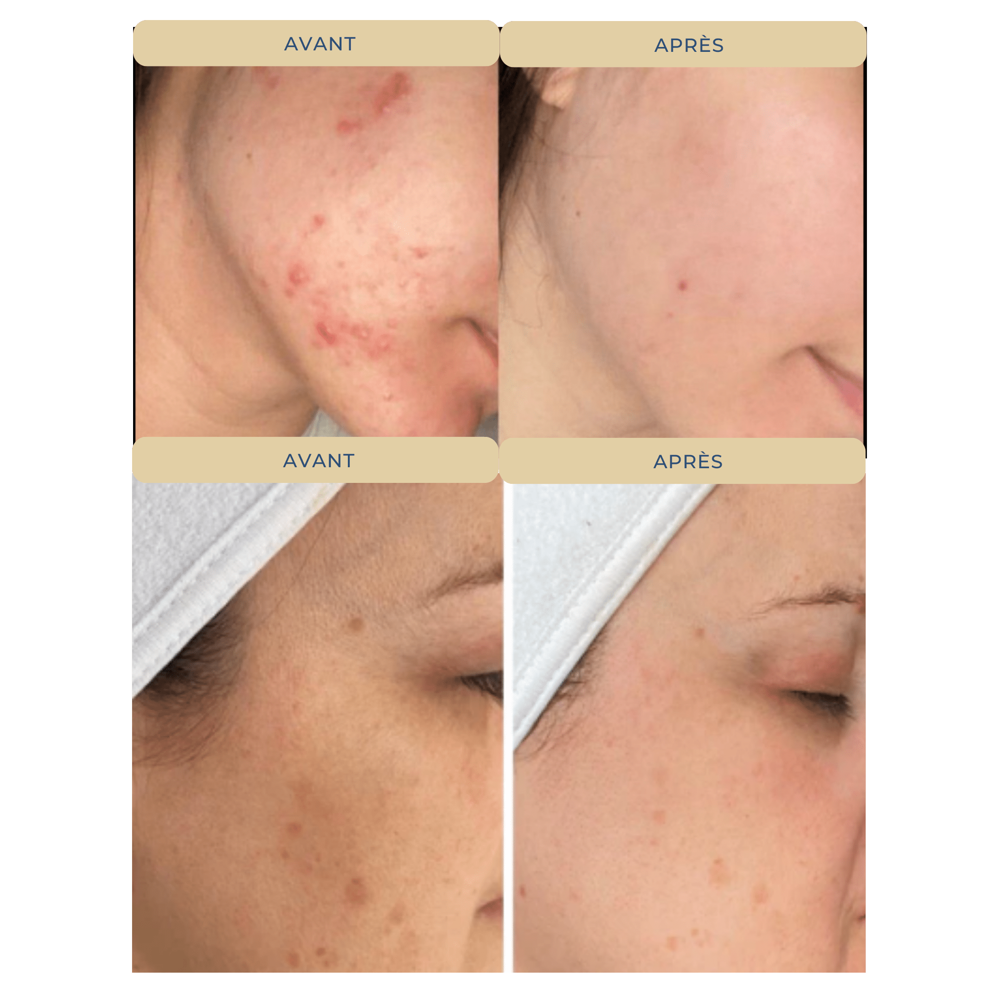 Sérum Éclat Vitamine C - Illumine & Protège - Glowyritual.com
